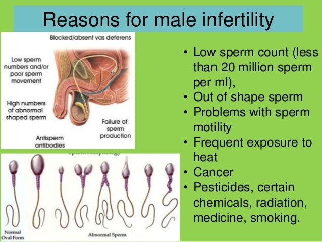 sperm count infertility Sperm count infertility